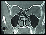 evaluacion-tomografica